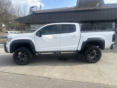 2017 Chevrolet Colorado 4WD Z71